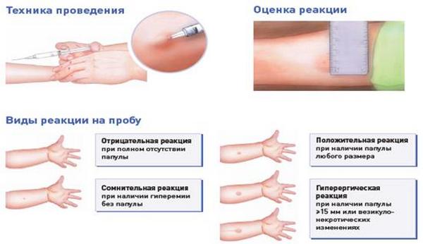 Таблиця по манту