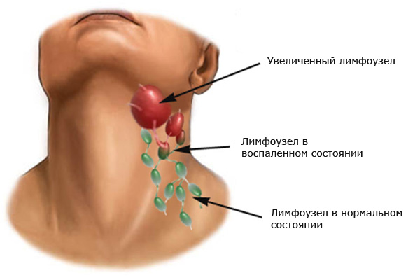 лімфовузли