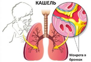 розрідження мокротиння