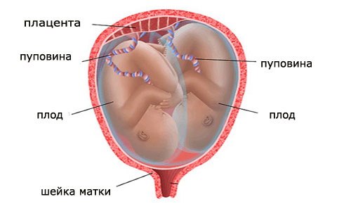 Багатоплідна вагітність: ознаки на ранніх термінах